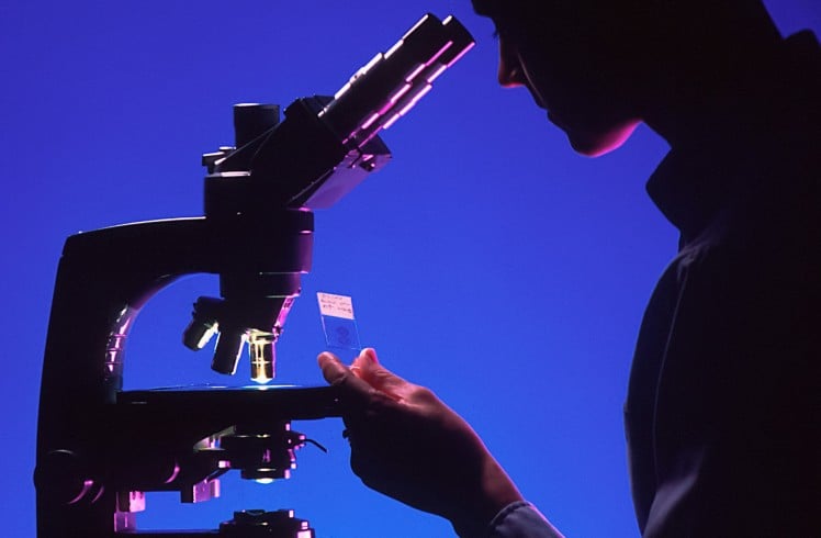 A silhouetted person peers into a microscope, holding a specimen slide against a vibrant blue background. Text: '2019/31 S', 'Bile duct cancer', 'K19-HH2-S', '00'.